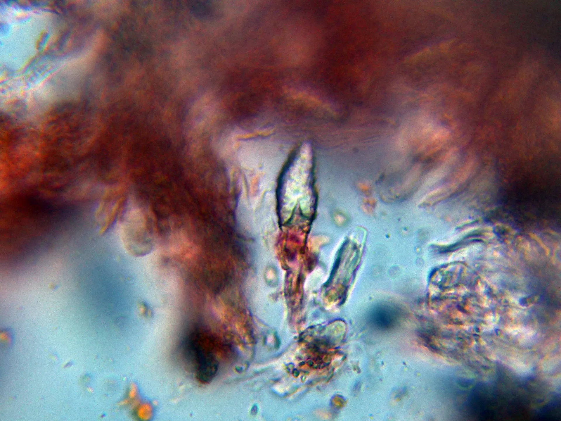 Microscopía de Peniophora quercina - 10 - Cistidios-002
